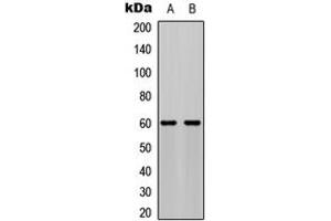 Western blot analysis of AKT (pS473) expression in MCF7 PDGF-treated (A), NIH3T3 PDGF-treated (B) whole cell lysates. (AKT1 anticorps  (C-Term, pSer473))