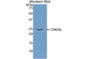 Western blot analysis of the recombinant protein. (SHBG anticorps  (AA 224-388))