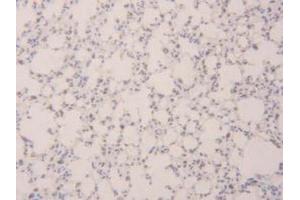 IHC-P analysis of Mouse Lung Tissue, with DAB staining. (SFTPB anticorps  (AA 20-193))