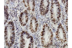 Immunoperoxidase of monoclonal antibody to HDAC1 on formalin-fixed paraffin-embedded human stomach.