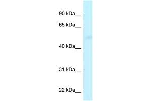 WB Suggested Anti-CPVL Antibody Titration: 1. (CPVL anticorps  (Middle Region))