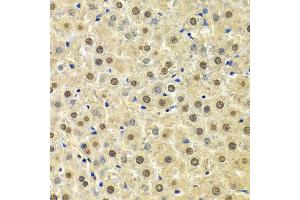 Immunohistochemistry of paraffin-embedded Rat liver using SPHK1 antibody at dilution of 1:100 (x400 lens). (SPHK1 anticorps)