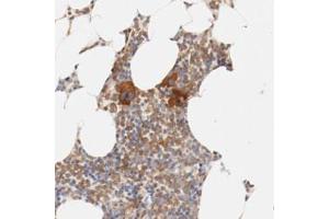 Immunohistochemical staining (Formalin-fixed paraffin-embedded sections) of human bone marrow with ZNF267 polyclonal antibody  shows strong cytoplasmic positivity in a subset of bone marrow poietic cells (megakaryocytes). (ZNF267 anticorps)