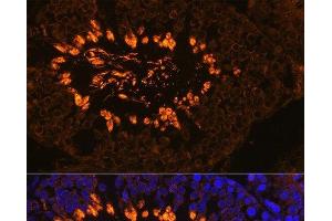 Immunofluorescence analysis of Rat testis using AKAP4 Polyclonal Antibody at dilution of 1:100.