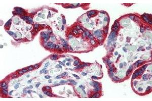 anti-PDGF-AA Homodimer (AA 87-211) antibody