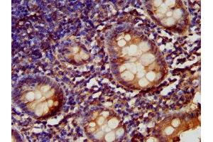 IHC image of ABIN7157812 diluted at 1:200 and staining in paraffin-embedded human appendix tissue performed on a Leica BondTM system. (LARP6 anticorps  (AA 294-453))