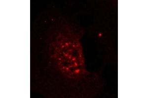 Immunofluorescence staining of methanol-fixed Hela cells showing nuclear dot staining using Akt(Phospho-Thr308) Antibody. (AKT1 anticorps  (pThr308))