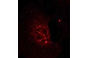 Immunofluorescence staining of methanol-fixed Hela cells showing nuclear dot staining using Akt(Phospho-Thr308) Antibody. (AKT1 anticorps  (pThr308))