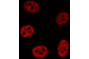 ABIN6276911 staining HepG2? (NR0B2 anticorps  (Internal Region))