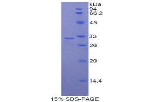SDS-PAGE (SDS) image for Myosin IC (MYO1C) (AA 728-987) protein (His tag) (ABIN1877765)