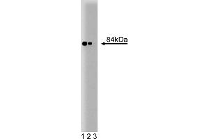 Western Blotting (WB) image for anti-Stromal Interaction Molecule 1 (STIM1) (AA 25-139) antibody (ABIN968271) (STIM1 anticorps  (AA 25-139))