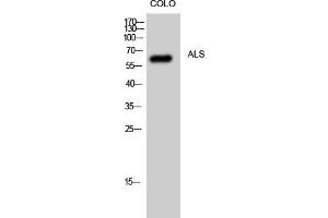 Western Blot analysis of CoLo cells using ALS Polyclonal Antibody.
