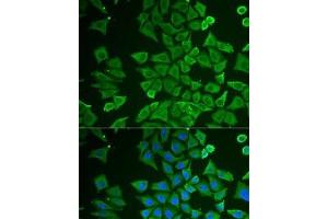 Immunofluorescence analysis of U2OS cells using DDAH2 Polyclonal Antibody (DDAH2 anticorps)