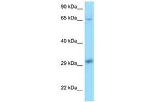 Image no. 1 for anti-Xeroderma Pigmentosum, Complementation Group A (XPA) (C-Term) antibody (ABIN6748095) (XPA anticorps  (C-Term))