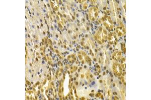 Immunohistochemistry (IHC) image for anti-Peptidylprolyl Cis/trans Isomerase, NIMA-Interacting 1 (PIN1) (AA 1-163) antibody (ABIN3022930)