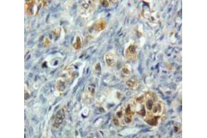 IHC-P analysis of Ovary tissue, with DAB staining. (TNFRSF10B anticorps  (AA 234-435))