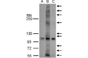 WB Image GPR30 antibody detects GPR30 protein by western blot analysis.