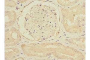 Immunohistochemistry of paraffin-embedded human kidney tissue using ABIN7167403 at dilution of 1:100 (RAP2B anticorps  (AA 1-183))
