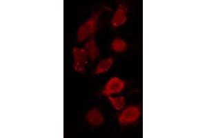 ABIN6267011 staining Hela by IF/ICC. (Topoisomerase II alpha anticorps  (Internal Region))