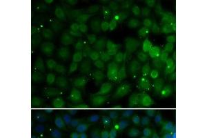 Immunofluorescence analysis of U2OS cells using HPD Polyclonal Antibody (HPD anticorps)