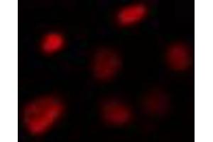 ABIN6274308 staining Hela cells by IF/ICC. (Foxk1 anticorps  (Internal Region))