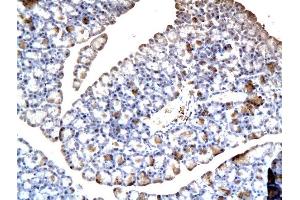 Formalin-fixed and paraffin embedded rat pancreatic tissue labeled with Anti-BSEP/ABCB11 Polyclonal Antibody, Unconjugated  at 1:200 followed by conjugation to the secondary antibody and DAB staining