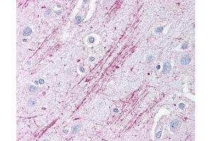 Anti-GDI2 antibody IHC of human brain, cortex.