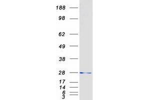 Validation with Western Blot