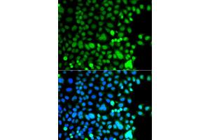Immunofluorescence analysis of A549 cells using AEBP2 antibody (ABIN5975286). (AEBP2 anticorps)