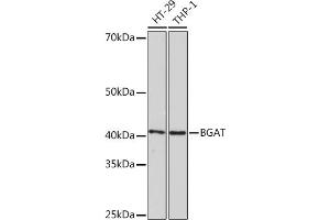 Western blot analysis of extracts of various cell lines, using BGAT Rabbit mAb (ABIN7267664) at 1:1000 dilution. (ABO anticorps)