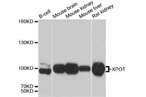 Western blot analysis of extracts of various cell lines, using XPOT antibody. (XPOT anticorps)