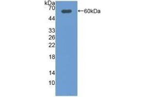 Detection of Recombinant DIO2, Rat using Polyclonal Antibody to Deiodinase, Iodothyronine, Type II (DIO2)