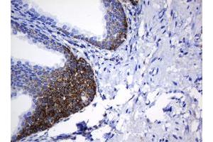 Image no. 8 for anti-NADH Dehydrogenase (Ubiquinone) 1 beta Subcomplex, 10, 22kDa (NDUFB10) antibody (ABIN1499672) (NDUFB10 anticorps)