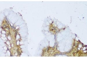 Immunohistochemistry of paraffin-embedded Human stomach using GCN1L1 Polyclonal Antibody at dilution of 1:150 (40x lens). (GCN1L1 anticorps)