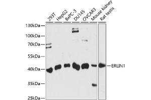 Western blot analysis of extracts of various cell lines, using ERLIN1 antibody (ABIN7267005) at 1:1000 dilution. (ERLIN1 anticorps  (AA 259-348))