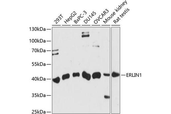 ERLIN1 anticorps  (AA 259-348)