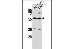ABCG4 Antibody (N-term) (ABIN656651 and ABIN2845892) western blot analysis in MDA-M,ZR-75-1 cell line lysates (35 μg/lane). (ABCG4 anticorps  (N-Term))