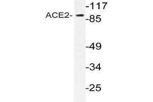 Western blot (WB) analyzes of ACE2 antibody in extracts from HeLa cells. (ACE2 anticorps)