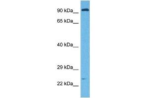 Host:  Rabbit  Target Name:  E2F7  Sample Tissue:  Mouse Liver  Antibody Dilution:  1ug/ml