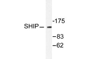 Image no. 1 for anti-Inositol Polyphosphate-5-Phosphatase, 145kDa (INPP5D) antibody (ABIN271812) (INPP5D anticorps)