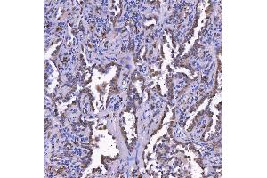 IHC analysis of TOM1L1 using anti-TOM1L1 antibody (ABIN7602631). (TOM1L1 anticorps  (AA 9-448))