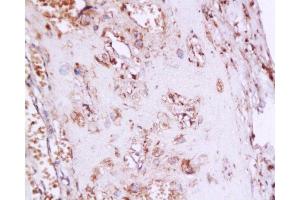 Formalin-fixed and paraffin embedded human placenta tissue labeledwith Anti-Phospho-Estrogen Receptor alpha (Ser167) Polyclonal Antibody, Unconjugated  at 1:200, followed by conjugation to the secondary antibody and DAB staining