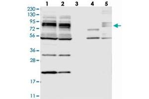 Western blot analysis of Lane 1: RT-4, Lane 2: U-251 MG, Lane 3: Human Plasma, Lane 4: Liver, Lane 5: Tonsil with MAK10 polyclonal antibody . (MAK10/NAA35 anticorps)