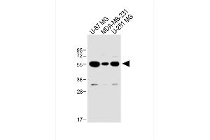 All lanes : Anti-USP17L24 Antibody (C-term) at 1:1000 dilution Lane 1: U-87 MG whole cell lysate Lane 2: MDA-MB-231 whole cell lysate Lane 3: U-251 MG whole cell lysate Lysates/proteins at 20 μg per lane.
