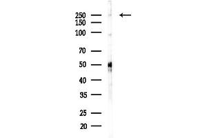 Western blot analysis of lysates from HepG2 cells(LPS,4h treatment), using PLCE1 Antibody at 1/1000 dilution.