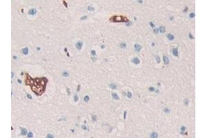 Detection of SHC3 in Human Cerebrum Tissue using Polyclonal Antibody to SHC-Transforming Protein 3 (SHC3)