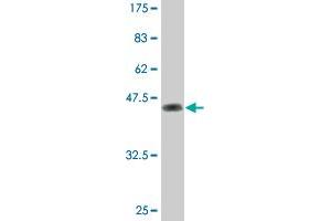 Western Blot detection against Immunogen (46. (Dual Specificity Phosphatase 3 (DUSP3) (AA 1-185) anticorps)