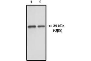 Image no. 1 for anti-Guanine Nucleotide Binding Protein (G Protein), beta 5 (GNB5) antibody (ABIN265062) (GNB5 anticorps)