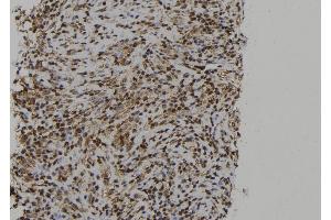 ABIN6273013 at 1/100 staining Human spleen tissue by IHC-P. (PTPN23 anticorps  (C-Term))