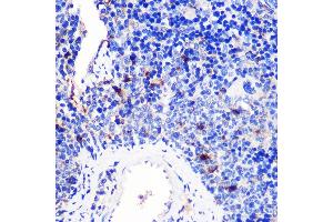 Immunohistochemistry of paraffin-embedded Mouse spleen using 4-1BB/CD137 Rabbit pAb (ABIN7271073) at dilution of 1:100 (40x lens).